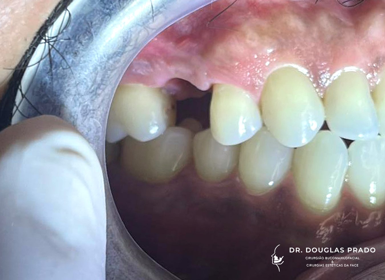 Antes-1.jpg Antes-1.jpg