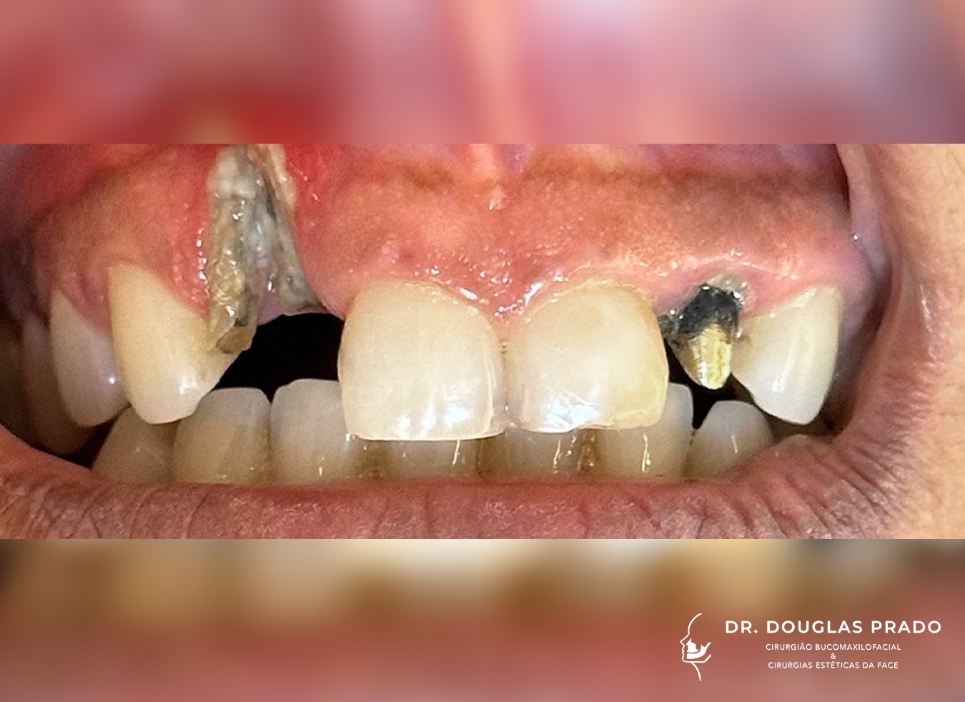 Antes-2.jpg Antes-2.jpg