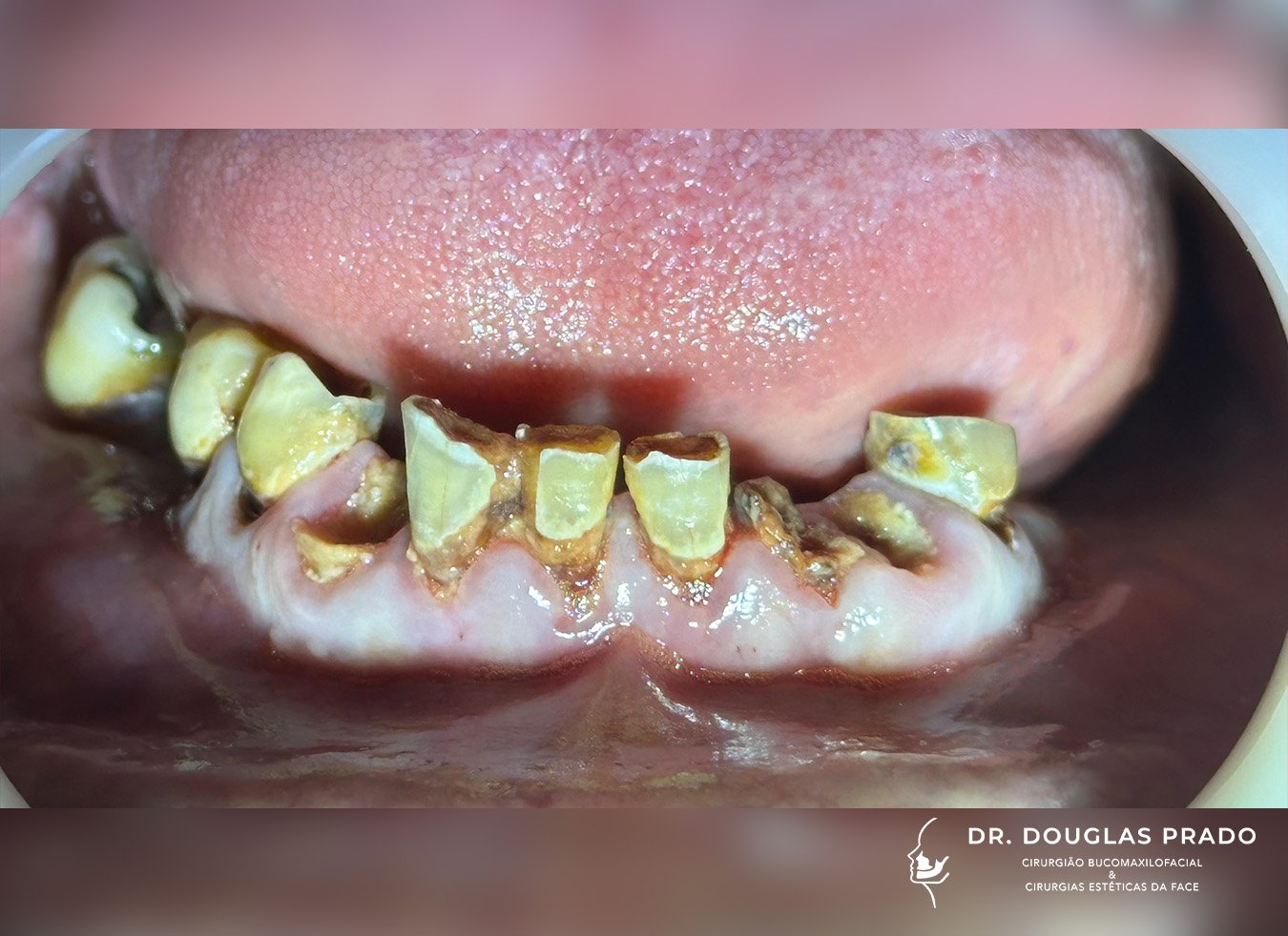 Antes-3.jpg Antes-3.jpg