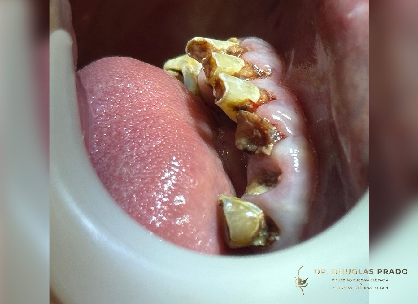 Antes-4.jpg Antes-4.jpg