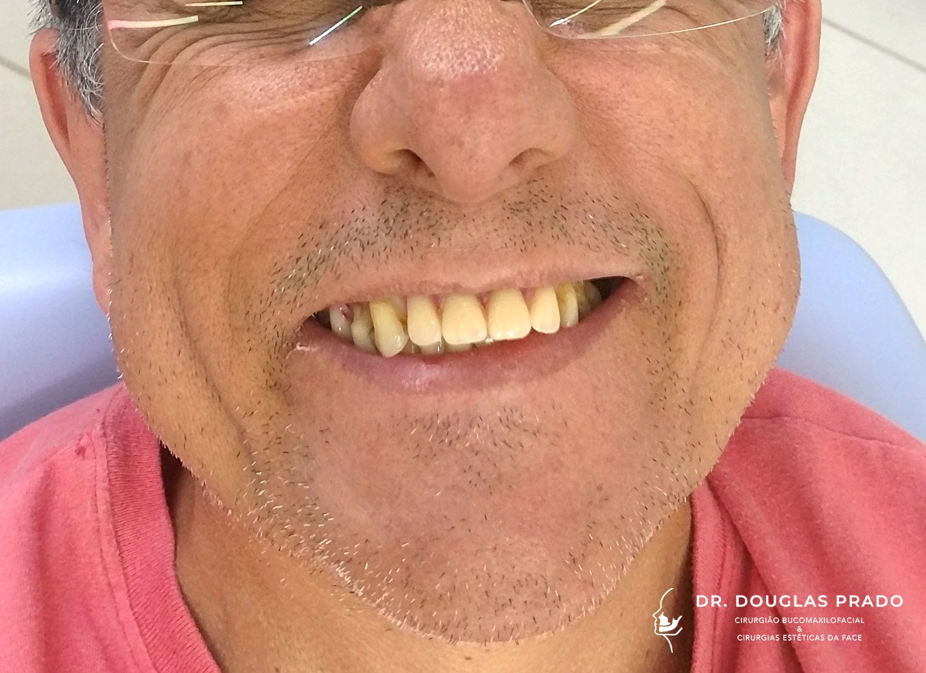 Antes-6.jpg Antes-6.jpg